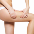 Cellulite estetica e infrarosso lontano